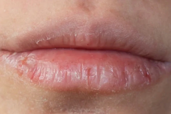 Bálsamo Labial Hidratante