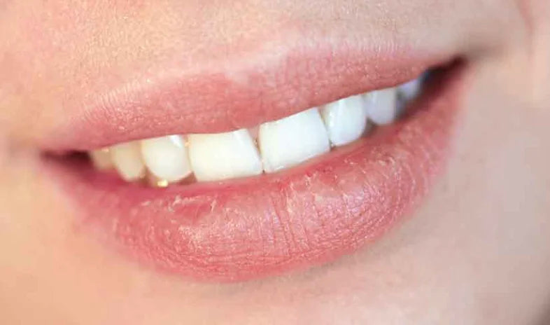 Bálsamo Labial Hidratante