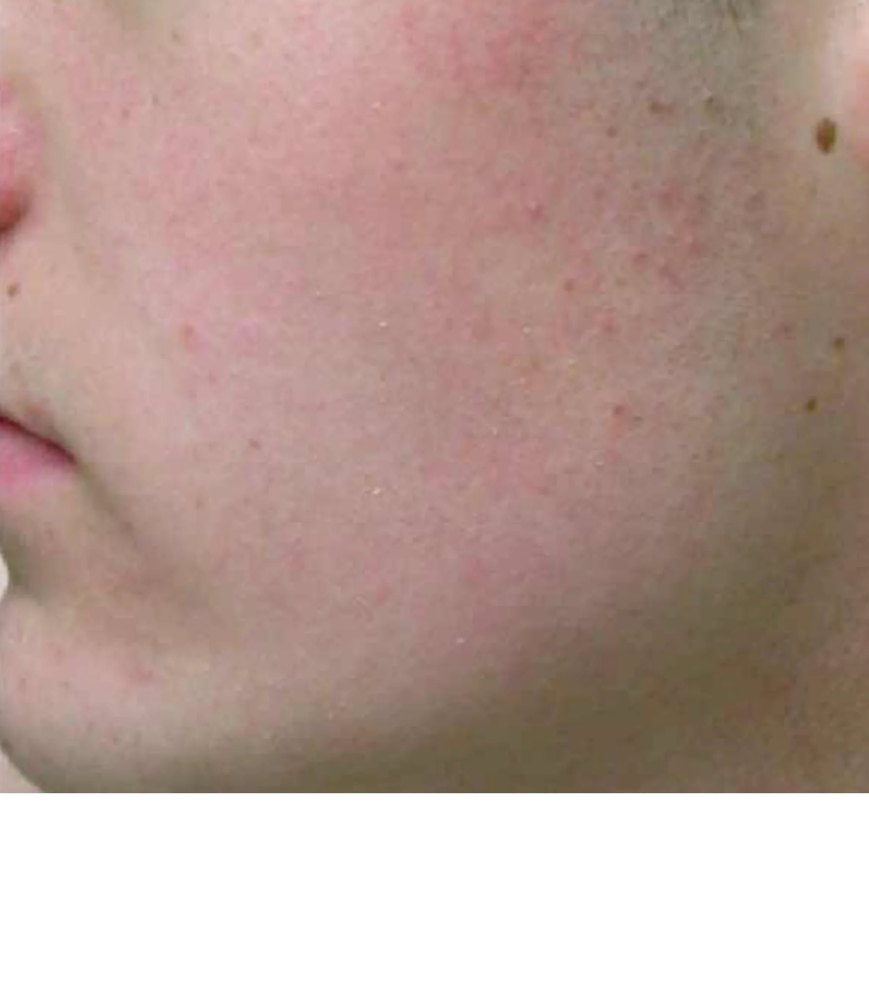Crema Facial Equilibrante